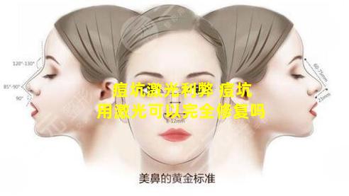 痘坑激光利弊 痘坑用激光可以完全修复吗